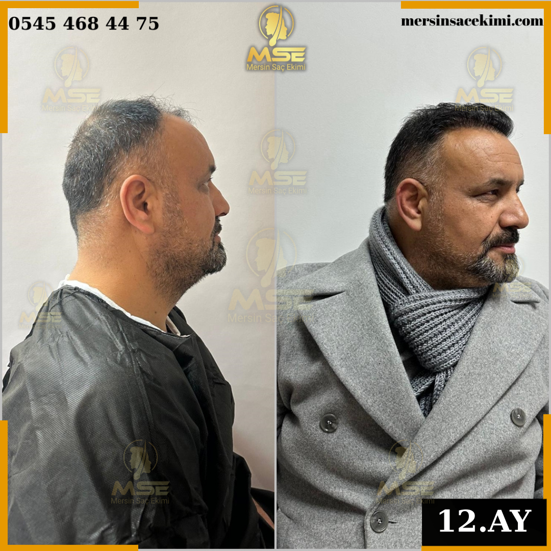 Ömer T.